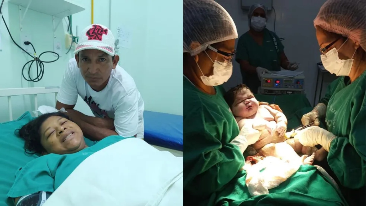 Recorde: ‘Bebê gigante’ nasce com mais de 7kg no Amazonas