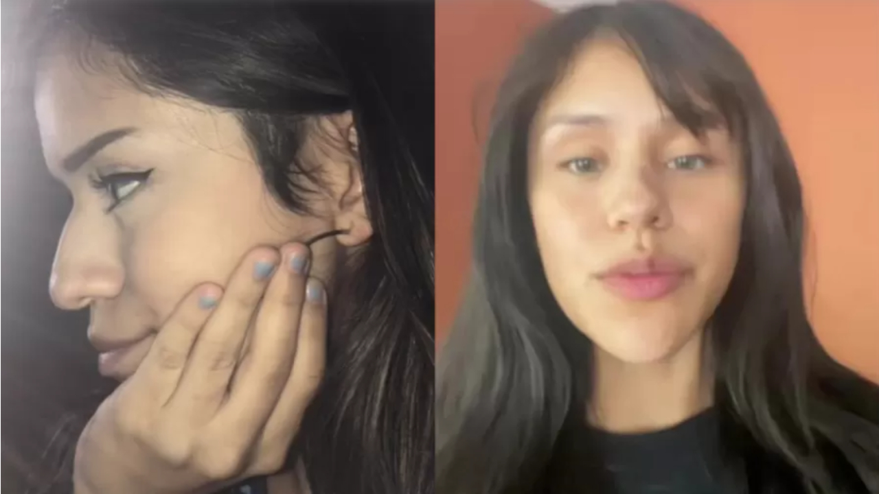 “Valeu a pena”, disse namorada que fez o ex pagar sua plástica no nariz, após ser traída