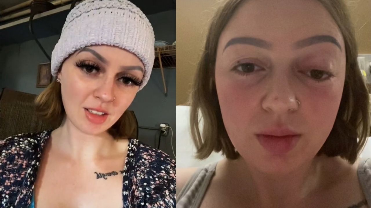 Mulher revela em Tiktok viral que olho “saltou” durante parto