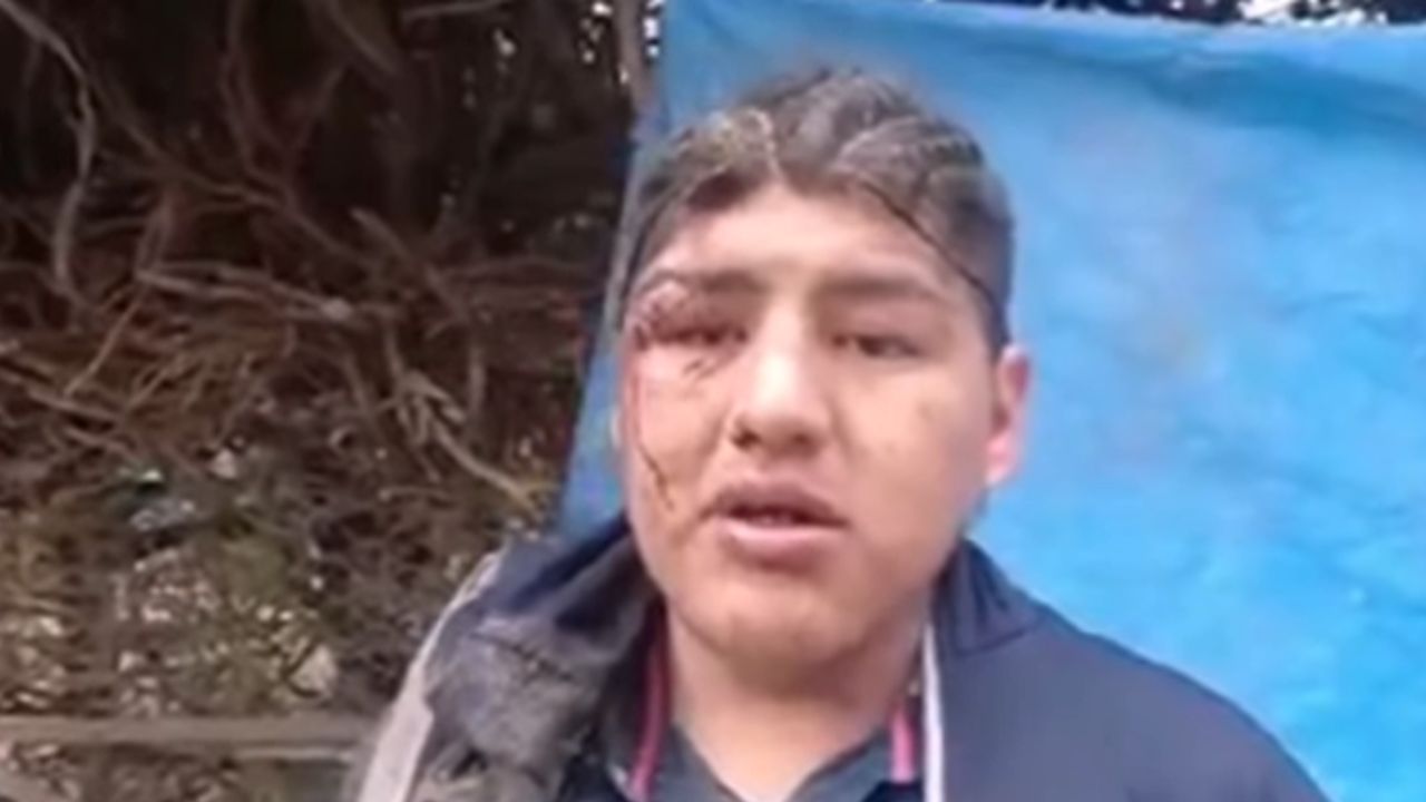 Homem é enterrado vivo como ‘oferenda’ em ritual na Colômbia: ‘Não conseguia me mexer’
