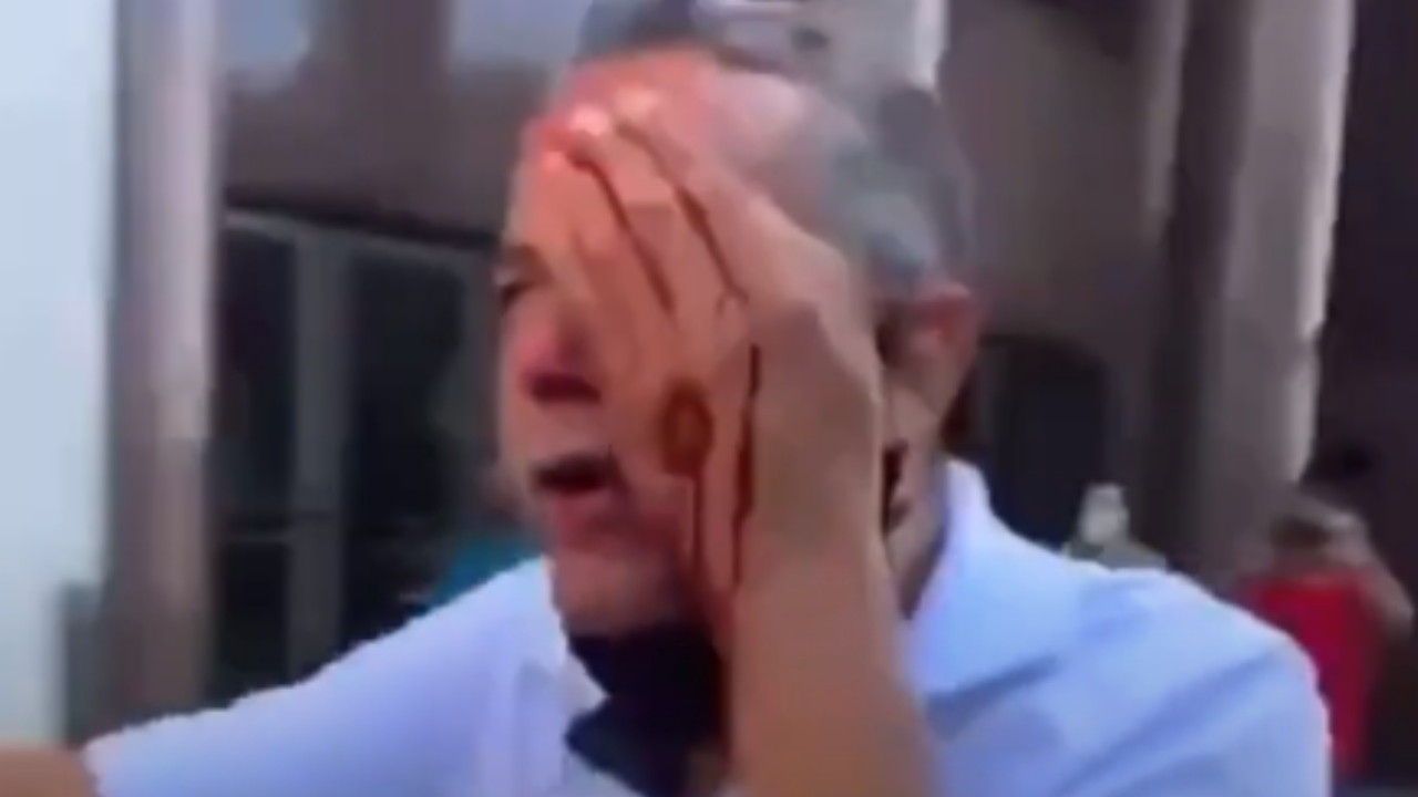 Homem atingido por bala de borracha em manifestação de Recife fica cego do olho esquerdo