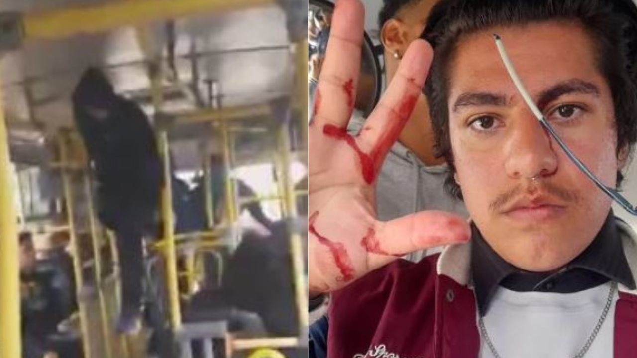 Bolsonaristas jogam pedra em ônibus e ferem estudante