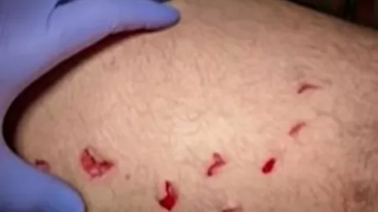 “Pude ver o rosto do tubarão”: pescador é atacado por tubarão-branco nos EUA