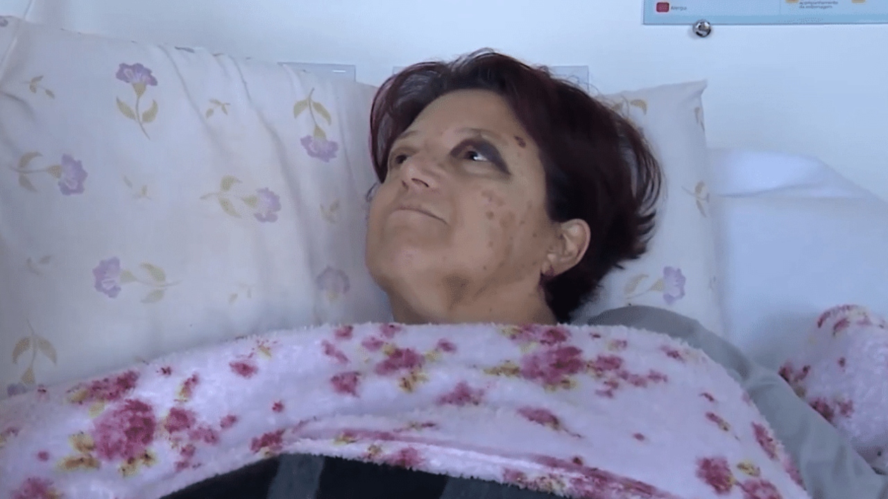 Ciclone deixa mulher presa em árvore por 36 horas