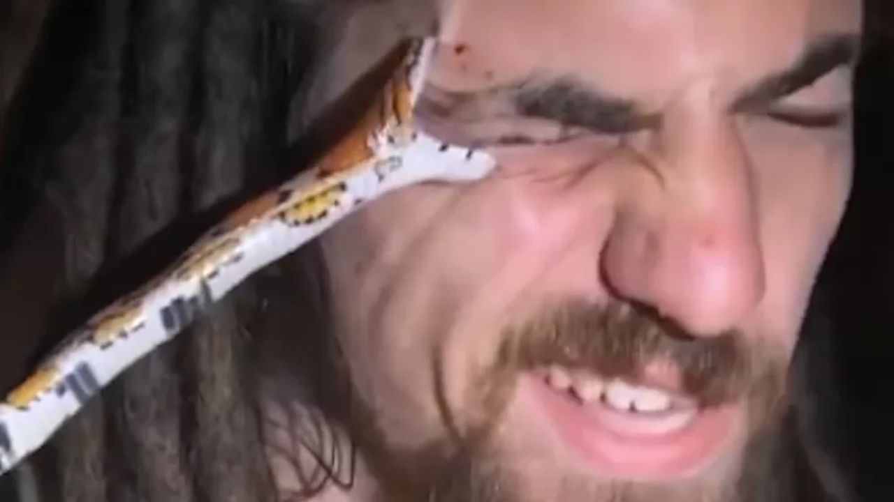 Vídeo: ‘Manipulador de répteis exóticos’ tem olho mordido por cobra