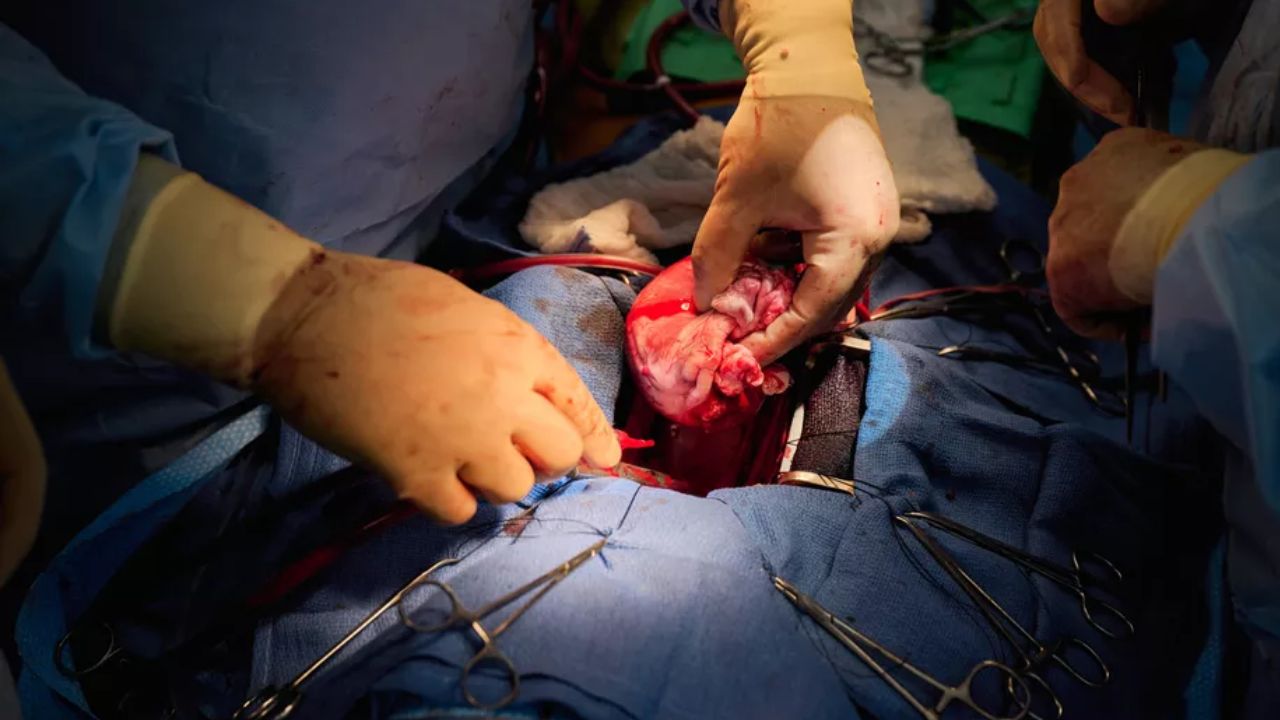 Corações de porcos são transplantados com sucesso a dois novos pacientes nos EUA