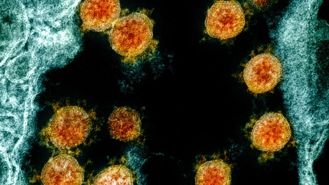 Fiocruz e Harvard explicam em estudo inflamação excessiva da covid-19