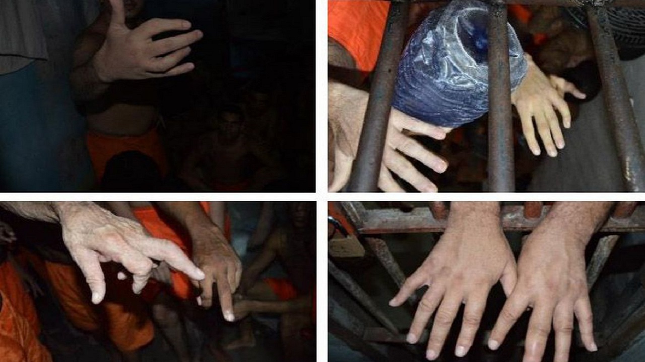Fratura de dedos: Técnica de tortura é constatada em 5 estados brasileiros