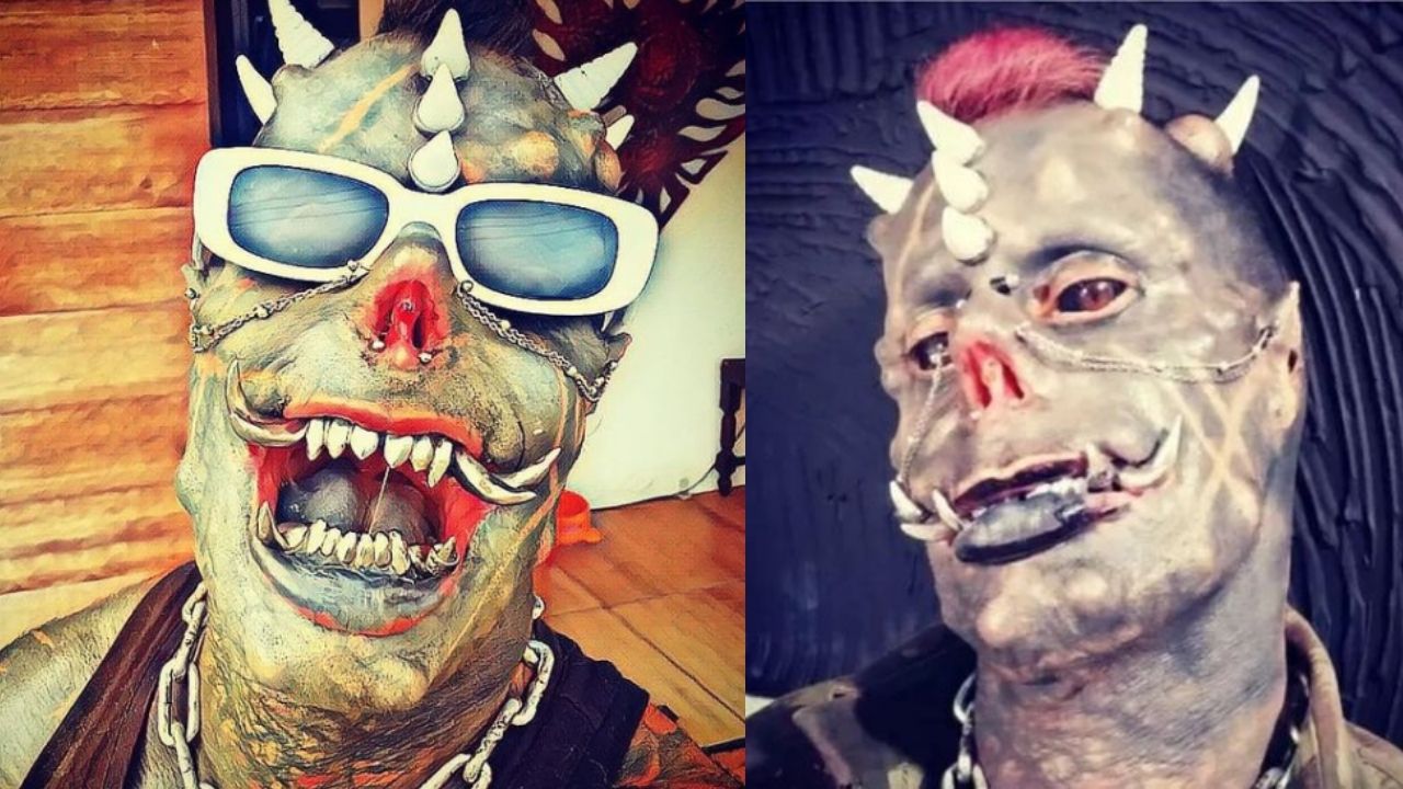 Brasileiro que tenta se parecer com o diabo passa por cirurgia e esposa agradece orações