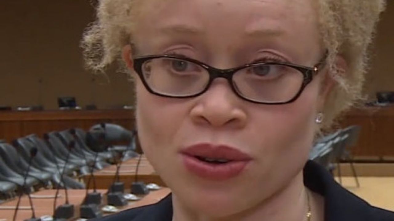 Especialista da ONU revela aumento de ataques a albinos: “Maior parte das vítimas são crianças”