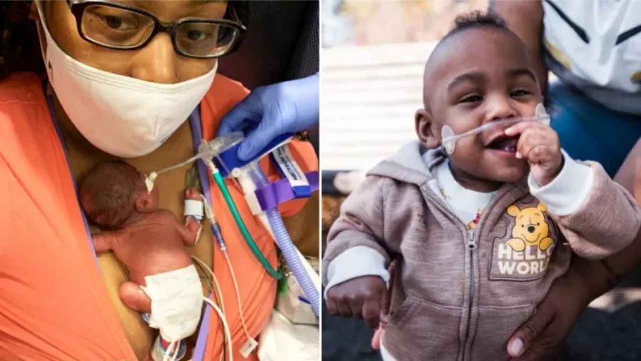 Nascido com 21 semanas, bebê bate recorde de mais novo prematuro a sobreviver