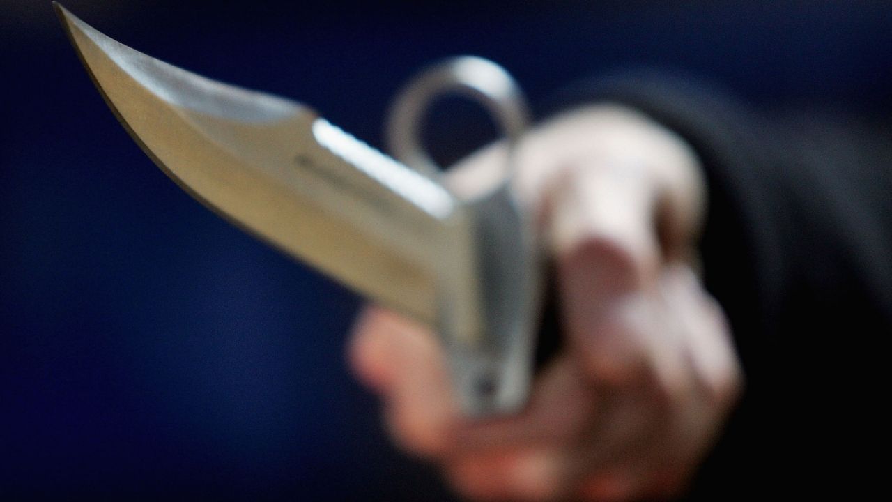 Por suposto abuso contra seu filho, mulher corta pênis de ex