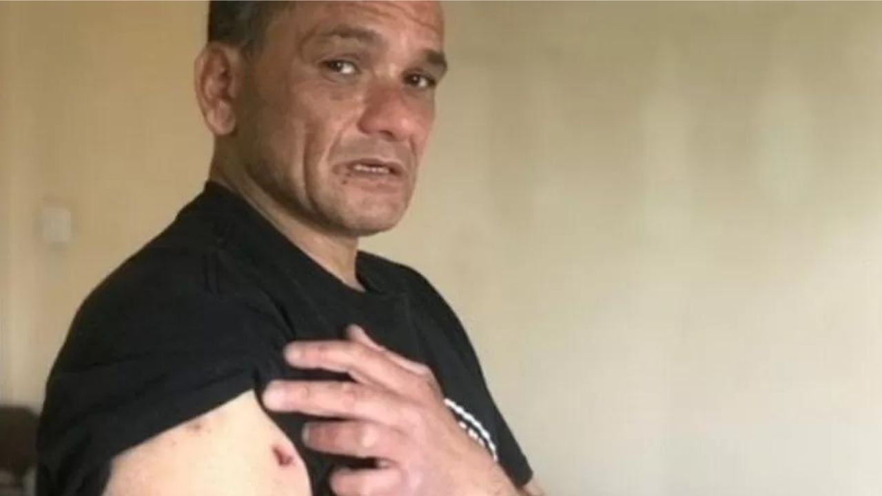 Homem sofre centenas de picadas devido a infestação de aranhas venenosas