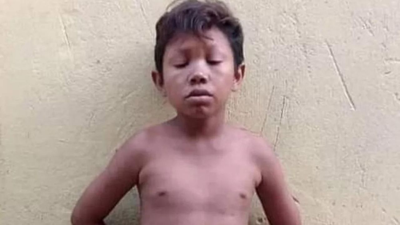 Conhecido como ‘Molequinho’, homem com aparência de criança é morto no Pará