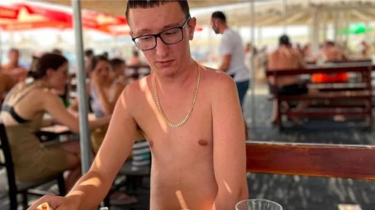 Aos 20 anos, jovem sofre de condição rara que faz com que seus ossos cresçam ‘fora do esqueleto’