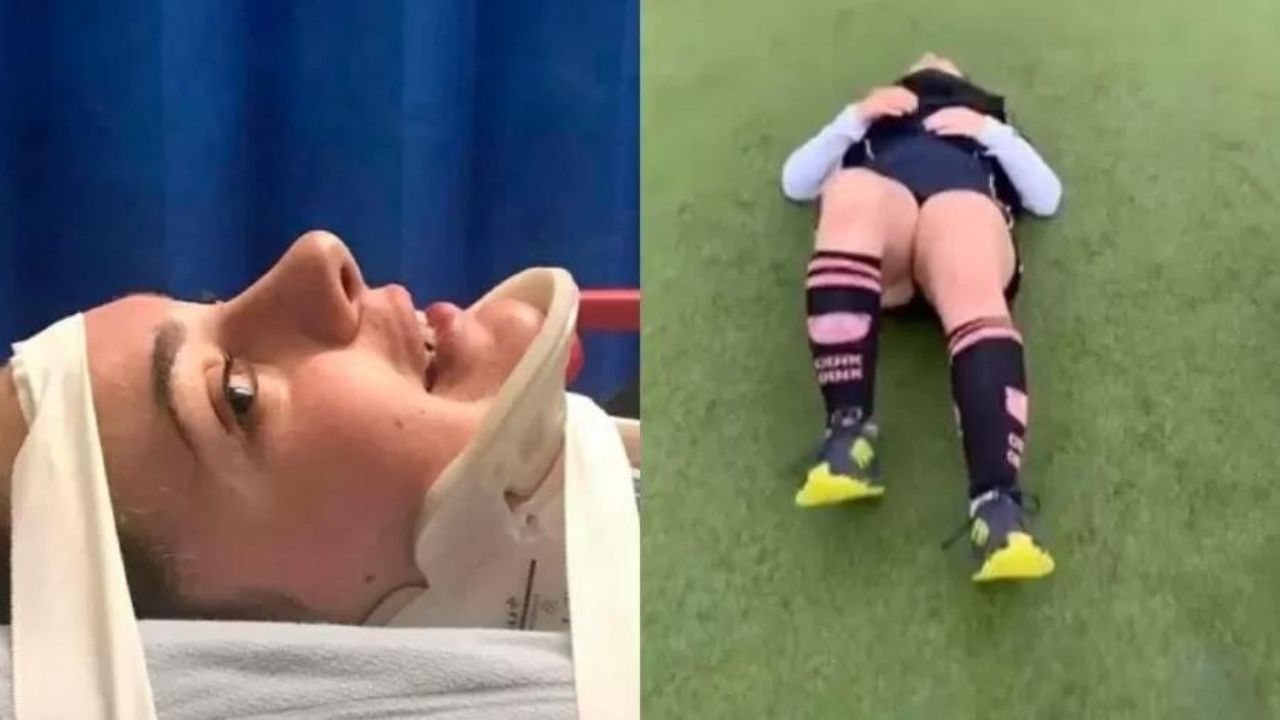 Dois anos após cumprir desafio do TikTok que resultou em fraturas, jovem fala sobre sequelas