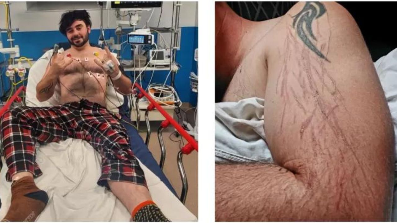 Homem sobrevive ao ser atingido por raio enquanto jogava videogame, no Reino Unido