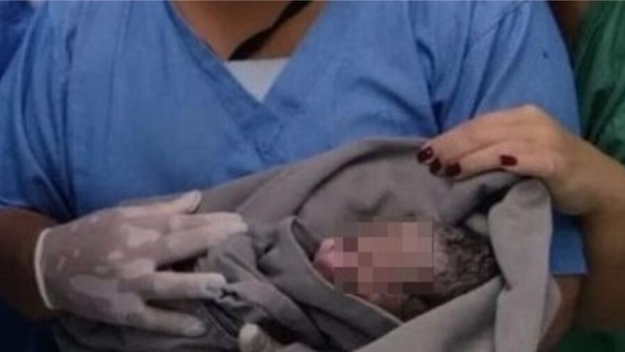 Bebê é encontrado no lixo por pessoa em situação de rua, em Bertioga
