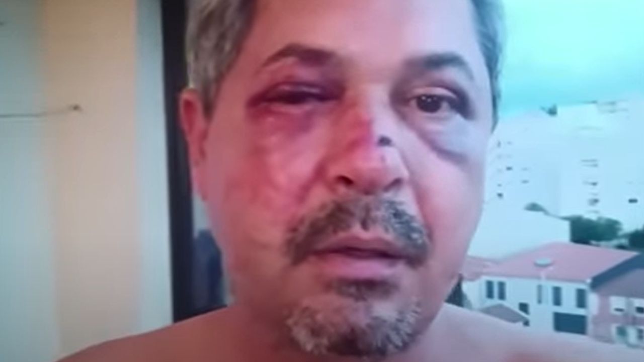 Vítima de xenofobia, brasileiro é agredido em Portugal: ‘Estou todo quebrado’