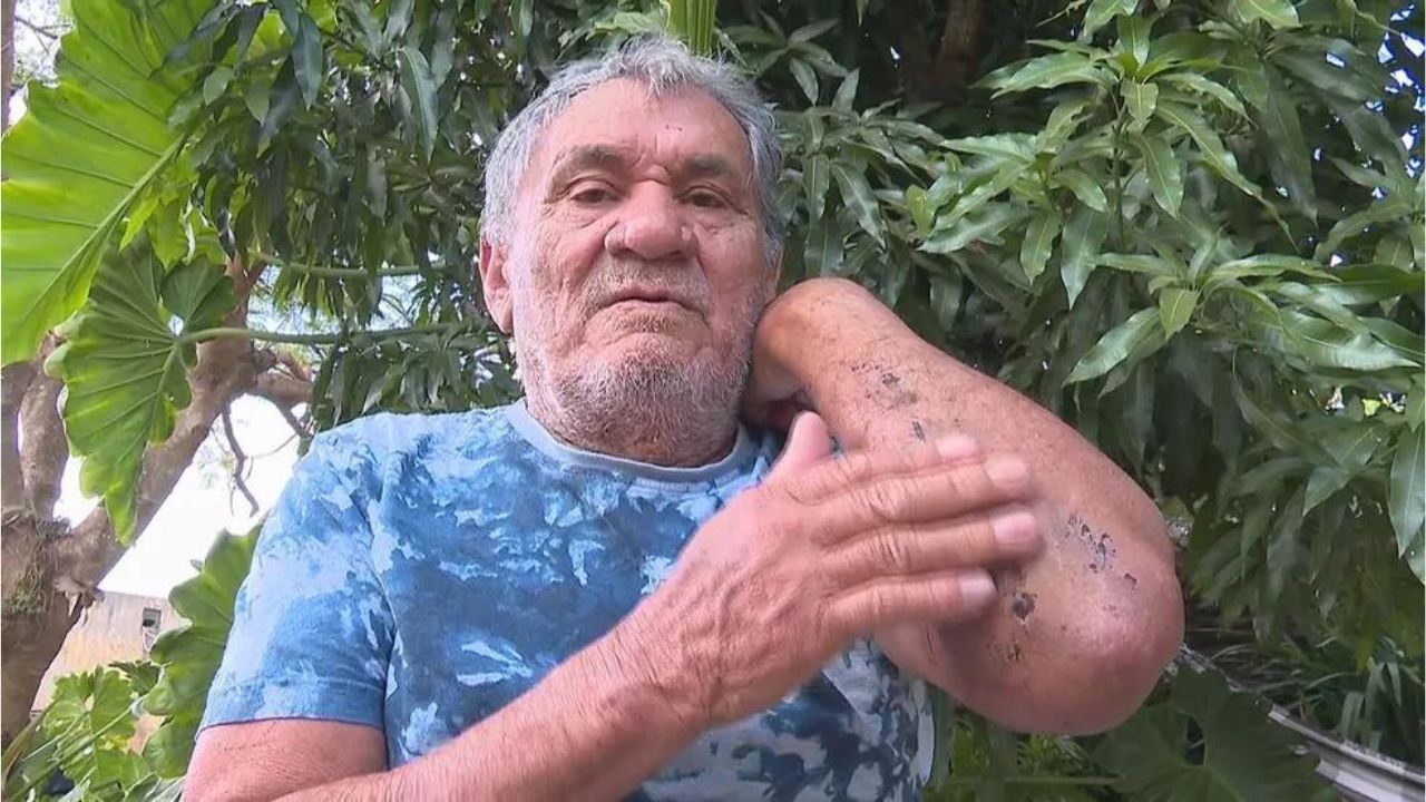 Idoso é encontrado após sete dias perdido em mata no Centro-Oeste
