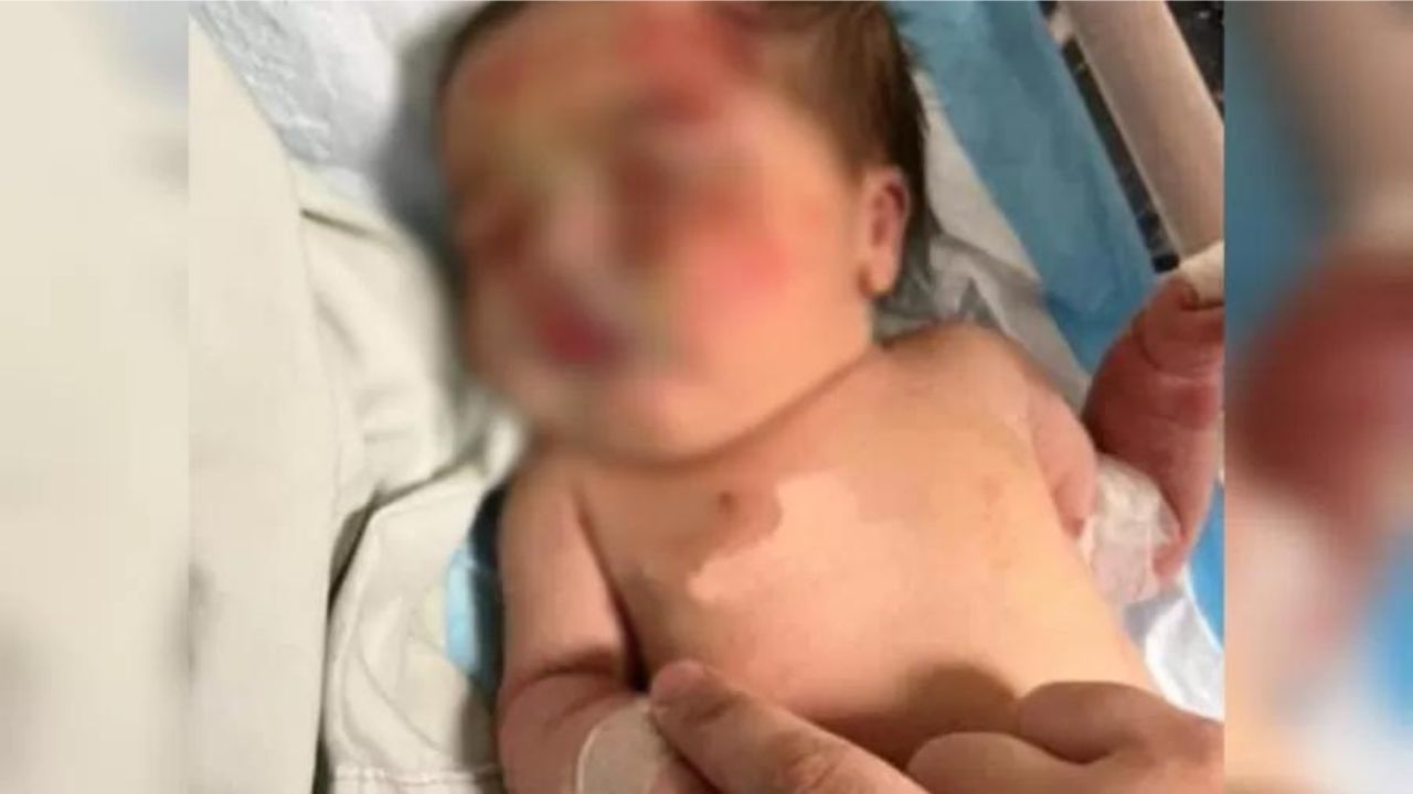 Líbano: Bebê abandonada é encontrada em sacola levada por cachorro