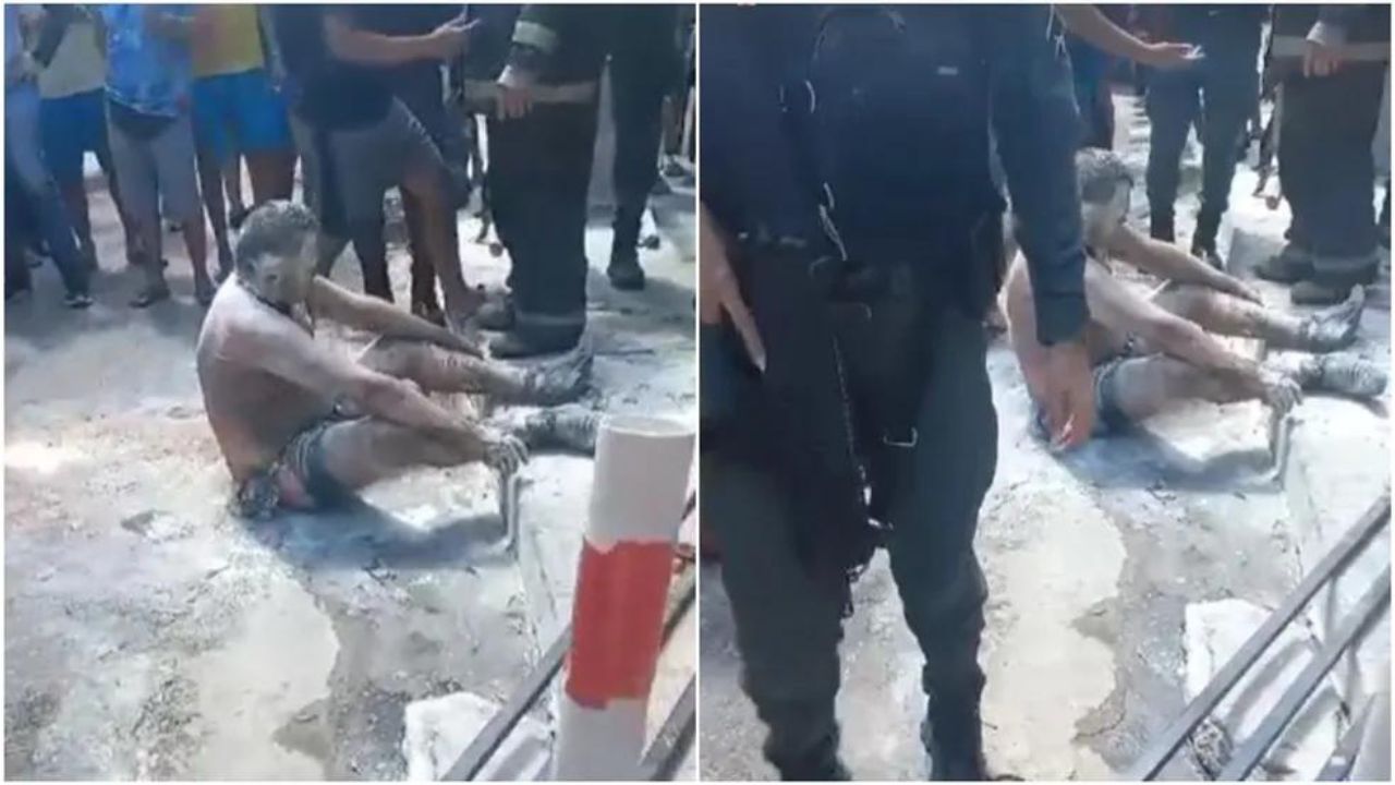 Homem sofre queimaduras ao tentar atear fogo na ex-companheira