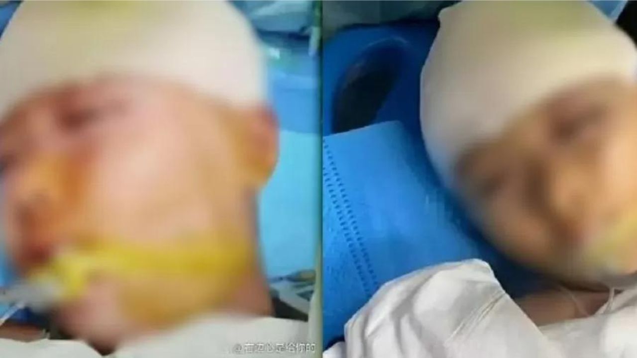 Menina sofre traumatismo craniano após ser agredida com régua por professor