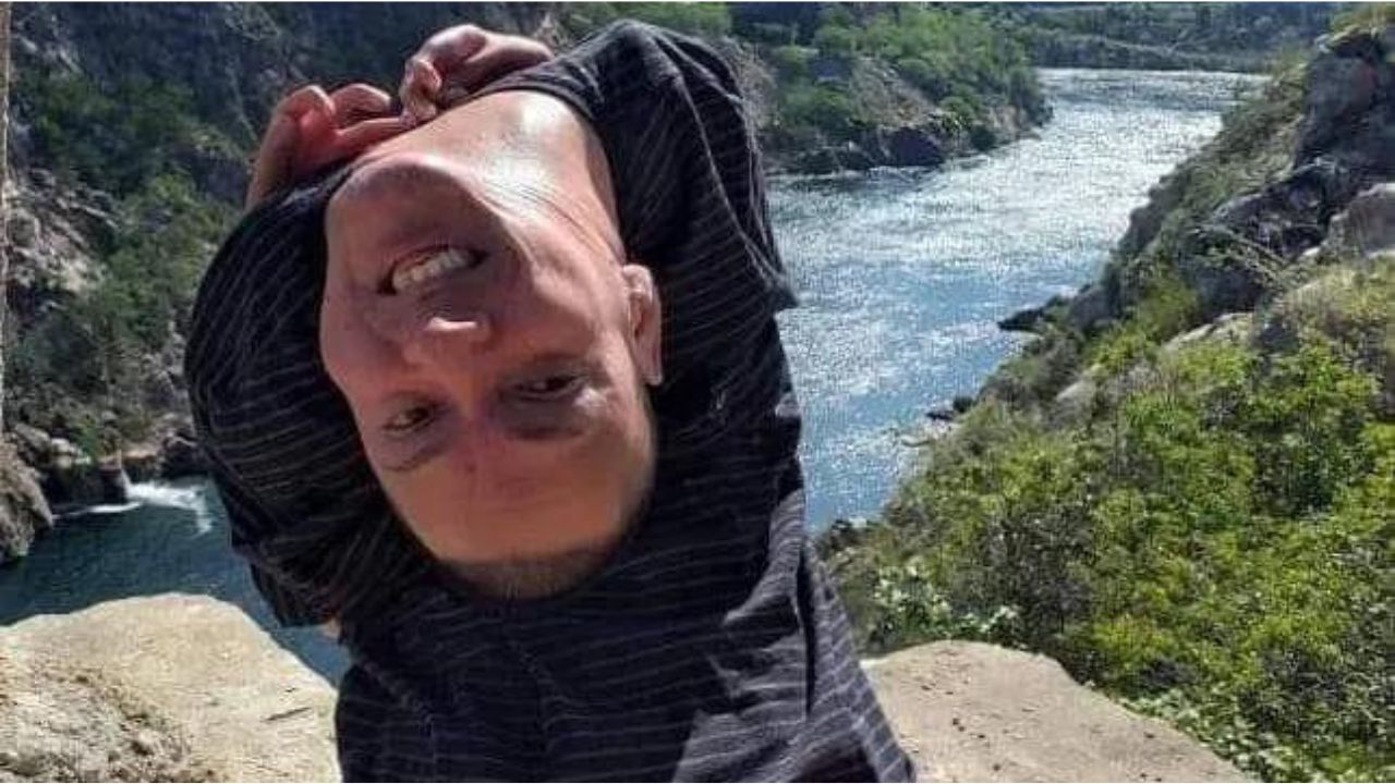 Brasileiro com cabeça invertida faz sucesso no Tiktok