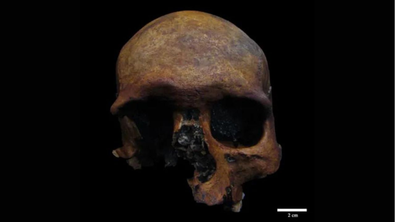 Pesquisadores encontram tumor craniano em esqueleto da era romana