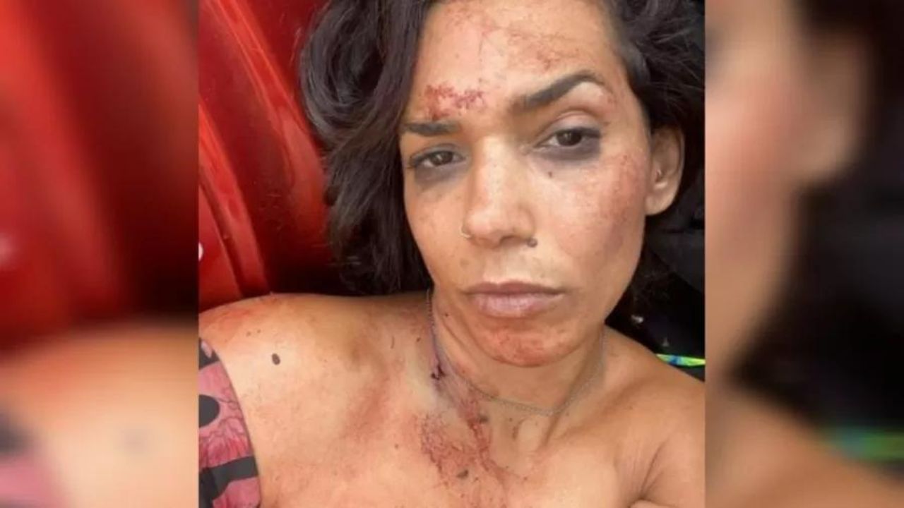 Israelense sobreviveu a ataque do Hamas em rave ao fugir de carro