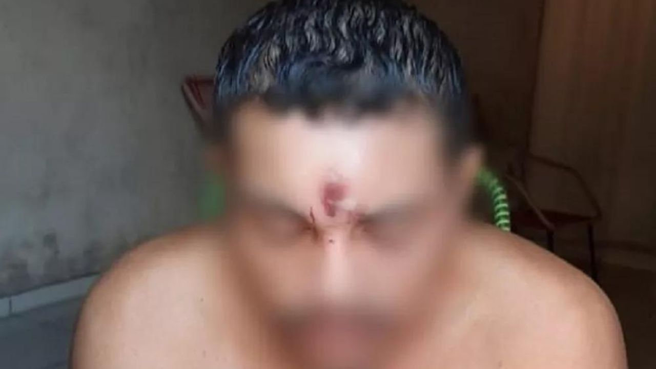 Homem é baleado na testa, larga moto na rua e dorme em casa