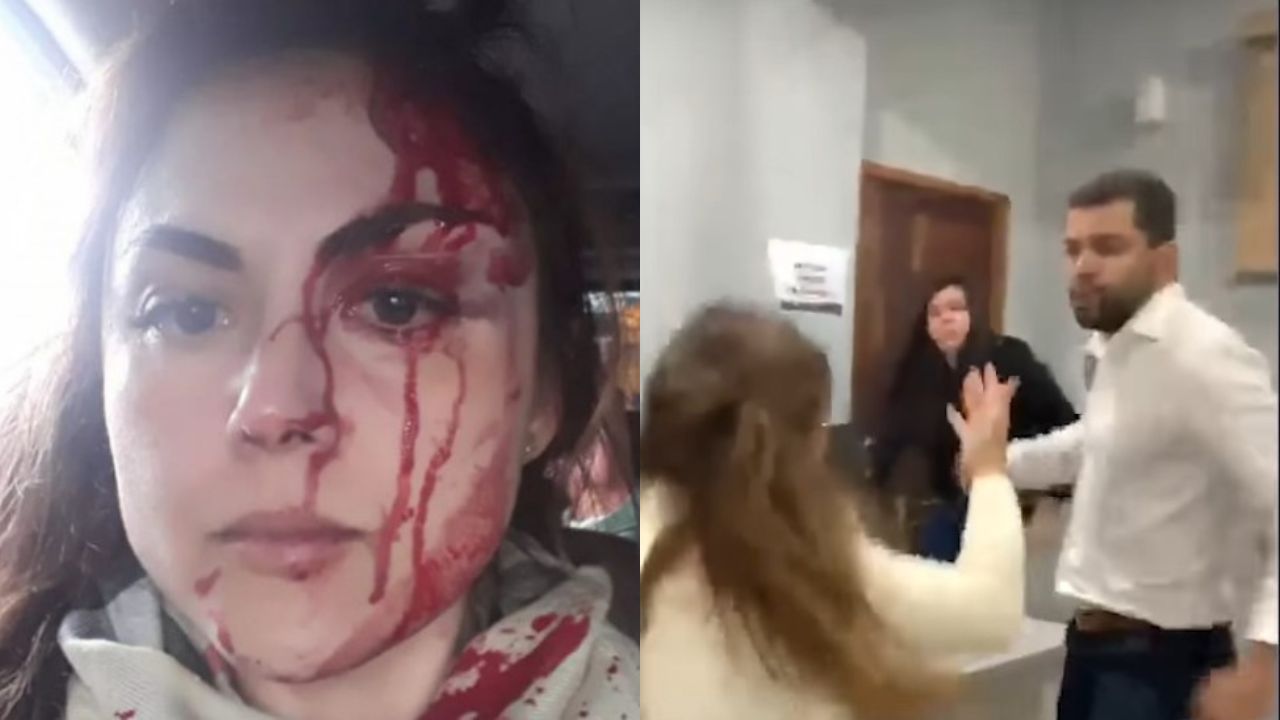 Procurador que espancou sua chefe é preso em São Paulo