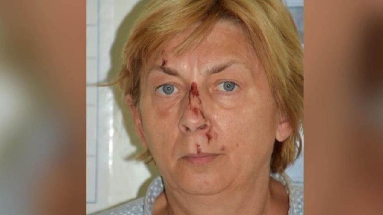 Na Croácia, autoridades se deparam com mulher ferida e sem memória