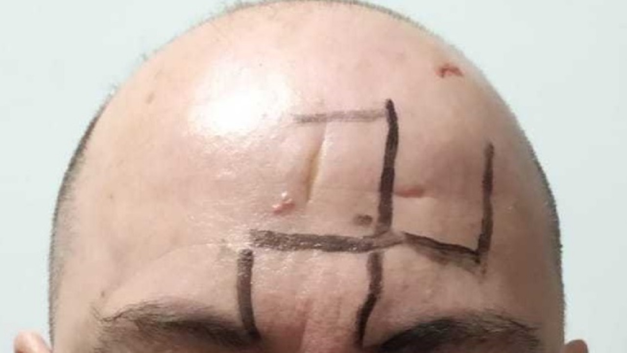 Desenharam suástica em sua testa: Empresário gay é dopado e atacado em MG