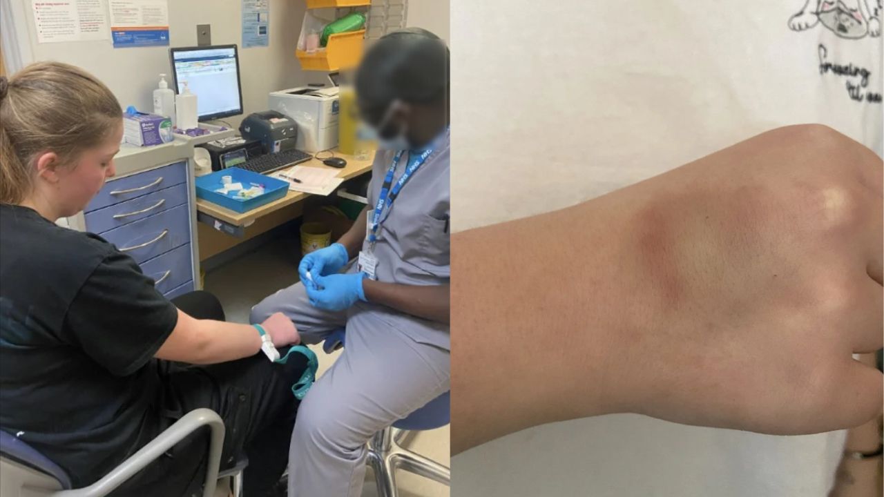 Enfermeiro atrai críticas após assistir futebol enquanto tirava sangue de paciente
