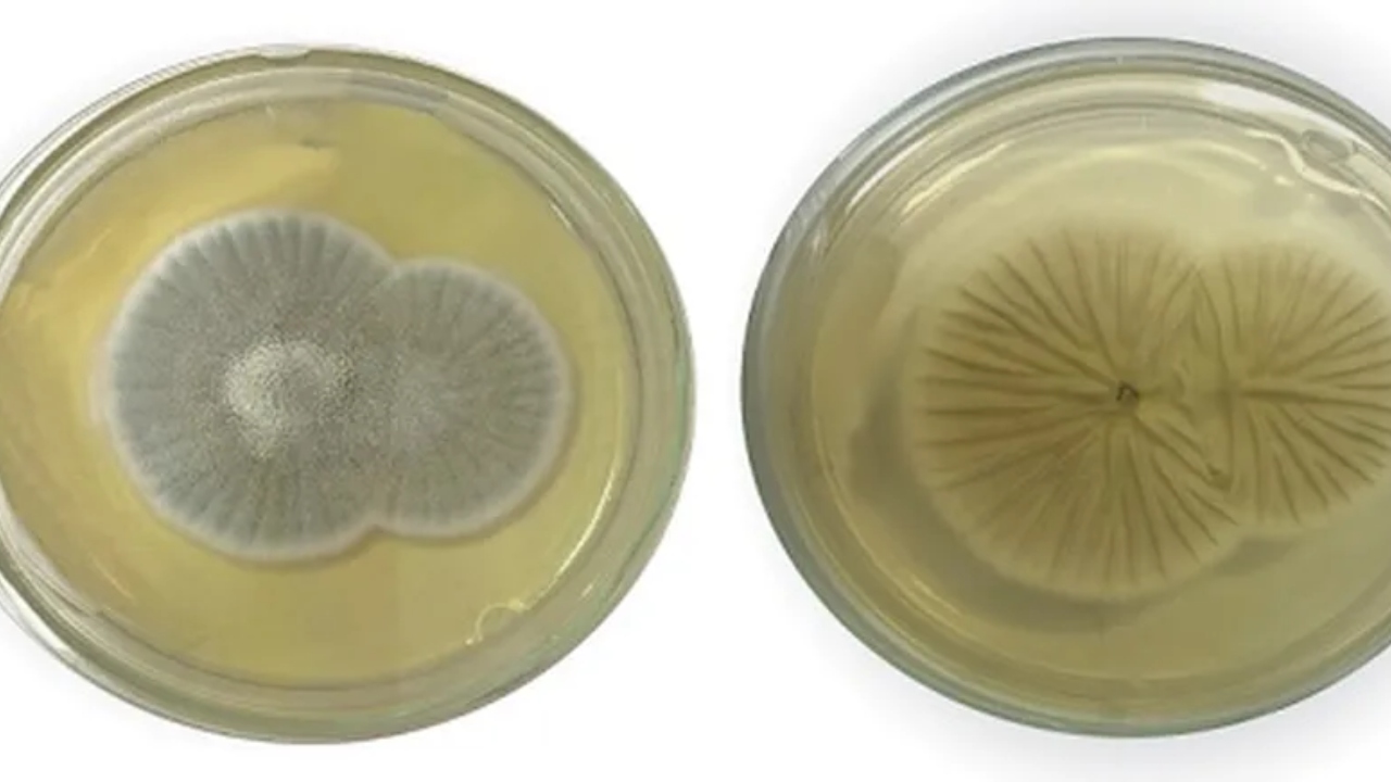 Fiocruz detecta 1º caso de doença por fungo Penicillium chrysogenum no Brasil