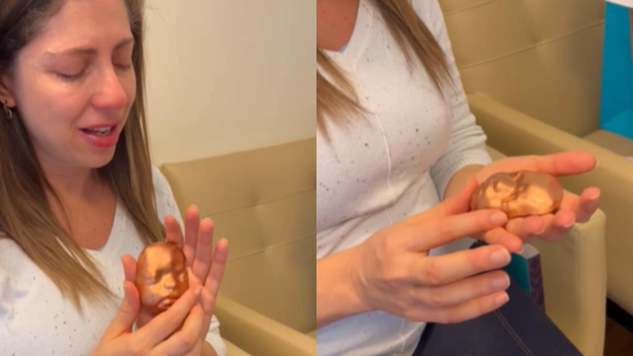 Gestante cega conhece rosto de seu bebê graças à impressão 3D