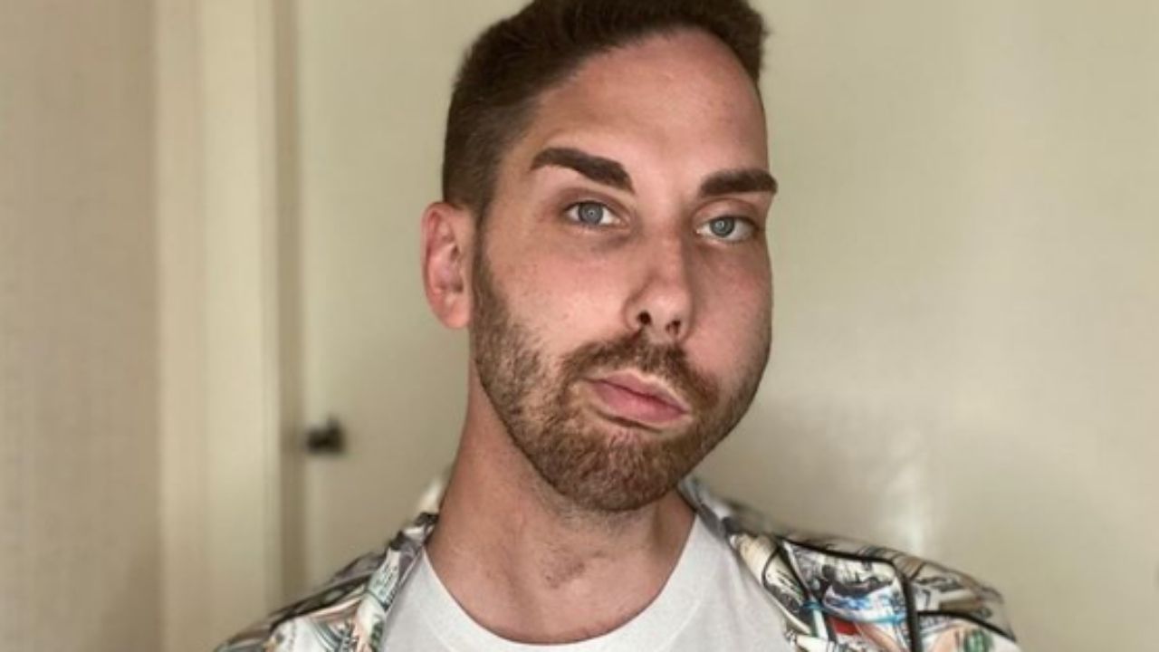 Homem com paralisia facial afirma que máscaras diminuíram discriminação