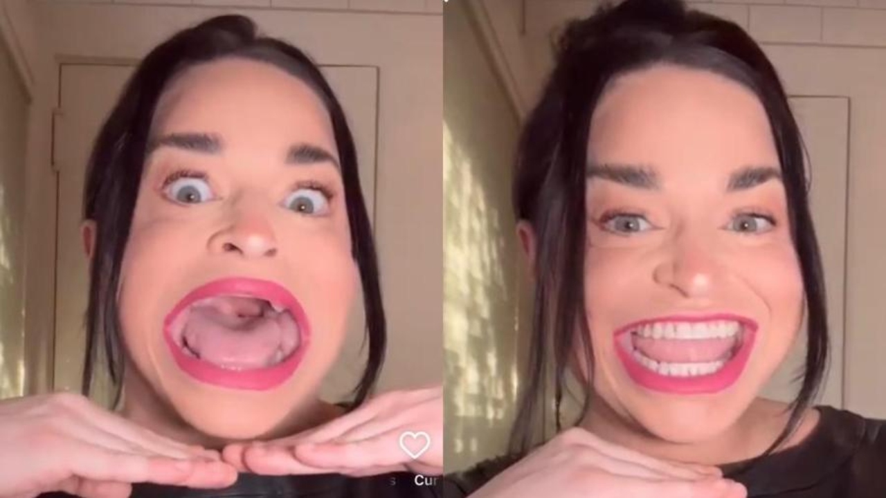 Maior boca do mundo: Influencer entra para o livro dos recordes devido a genética