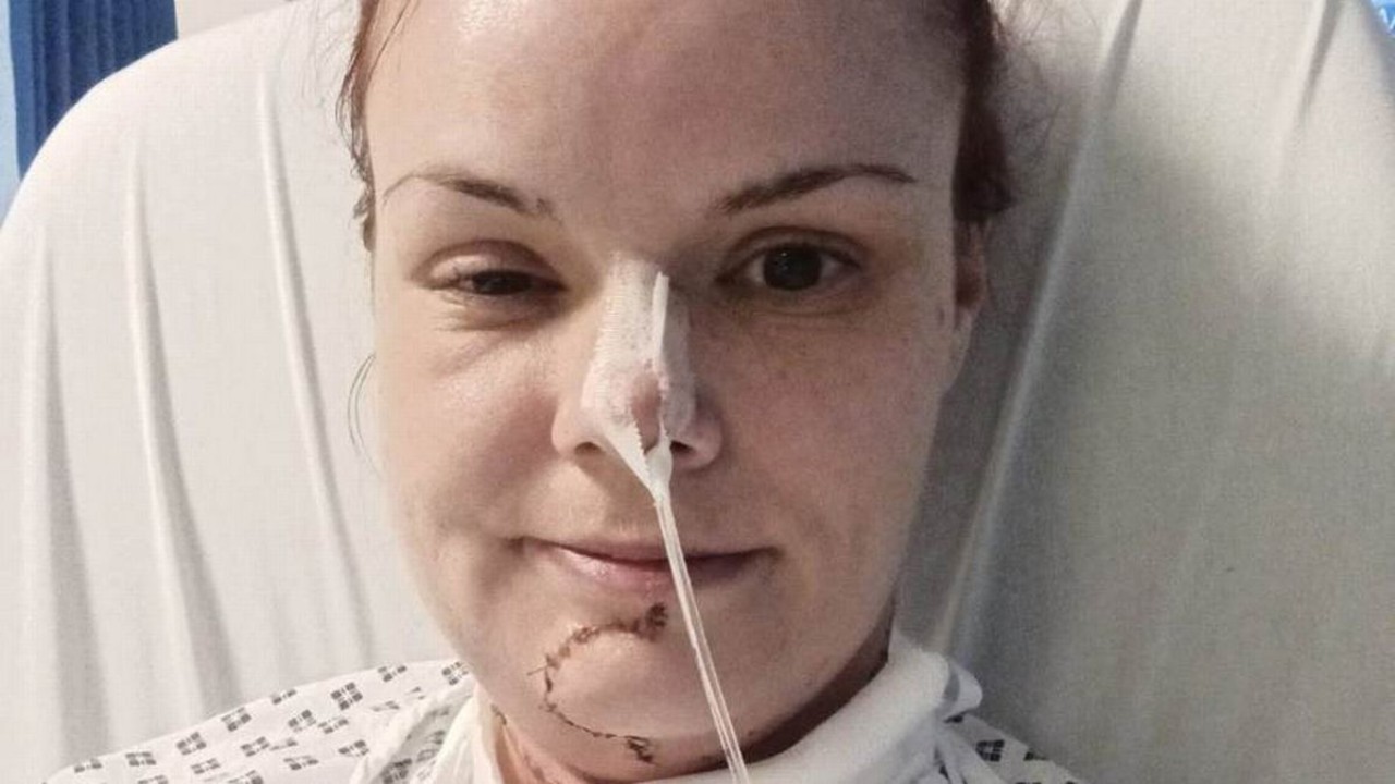 Mulher inglesa retoma a fala após perder 90% da língua por câncer agressivo