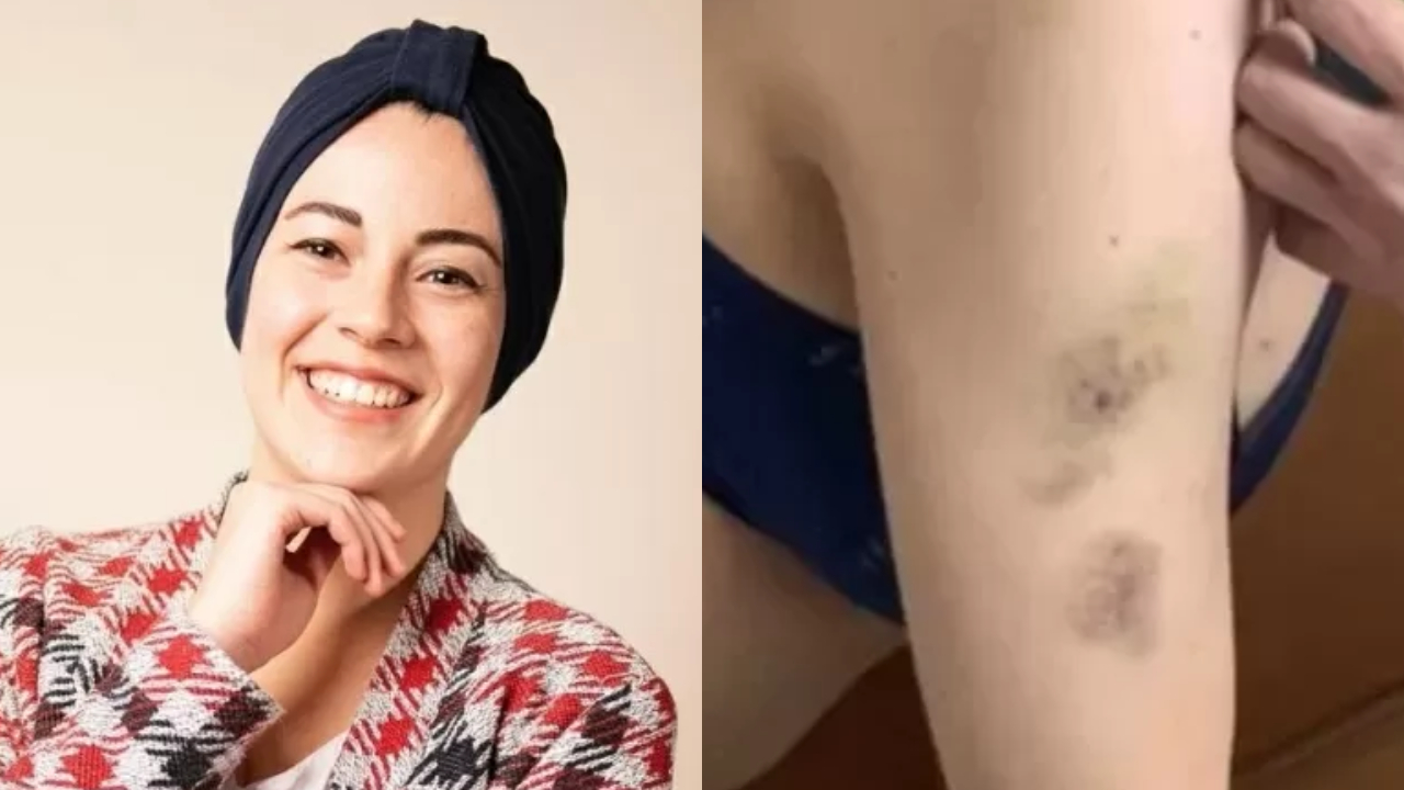Mulher que denunciou violência no Qatar relembra agressão: ‘Me deixou marcas no corpo’