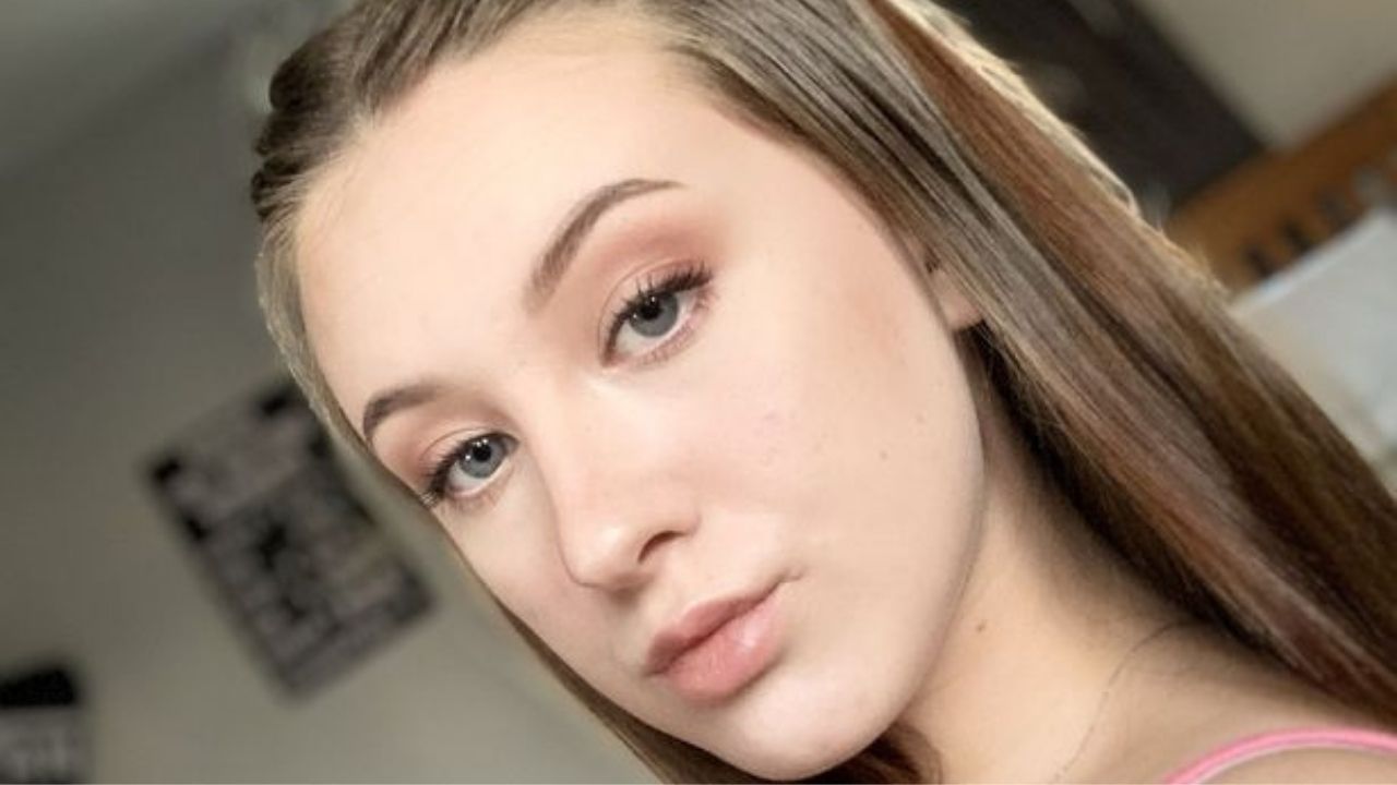 Jovem desenvolve doença que cobre sua pele de feridas: ‘Sinto como se tivesse sido esfaqueada’