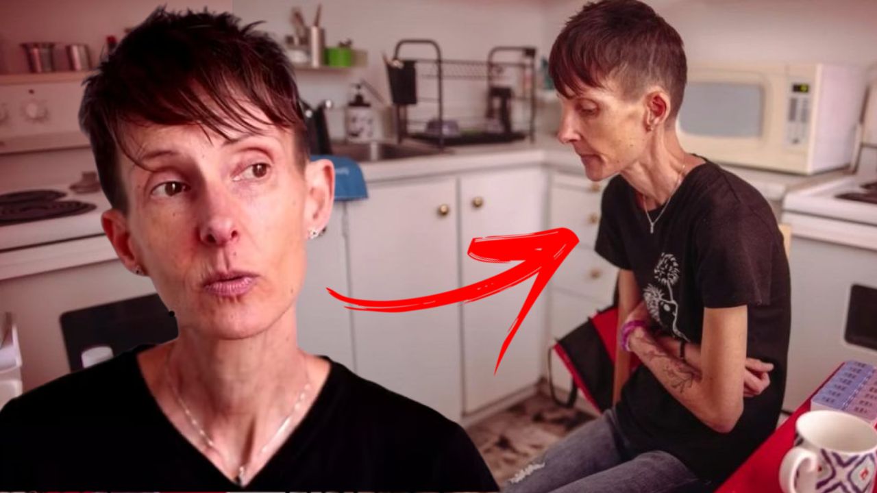 Lisa Pauli: A canadense com anorexia que pede ajuda ao governo para morrer
