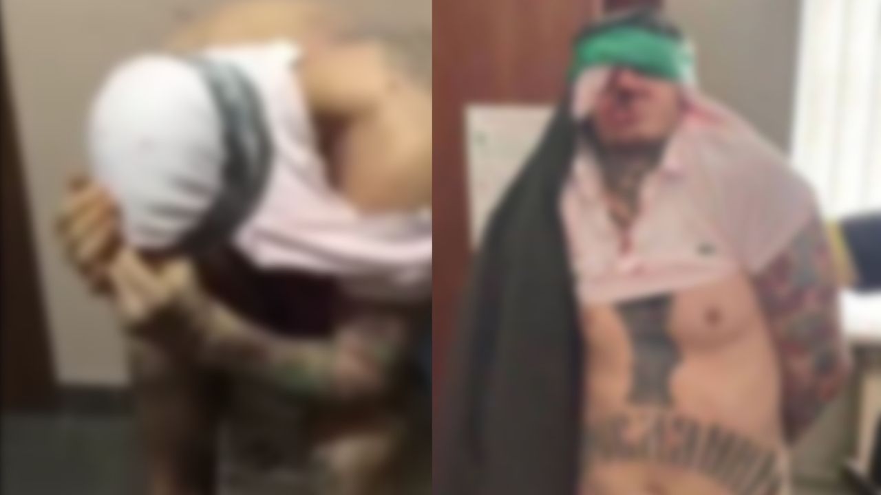 Lutador de MMA ucraniano teria sido torturado por neonazistas