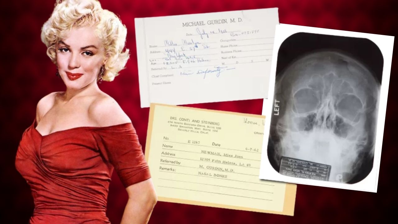 Revelados em documentos: os procedimentos estéticos feitos por Marilyn Monroe