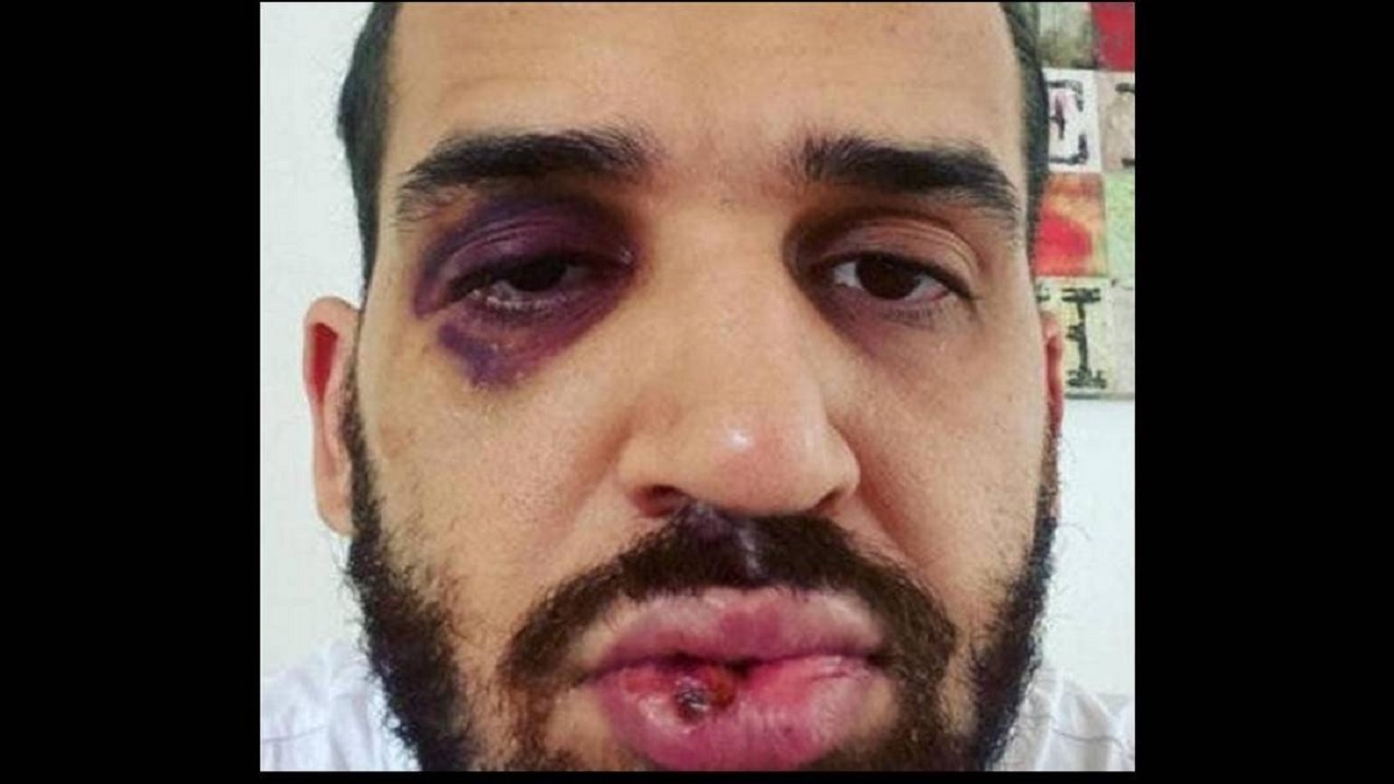 Médico defende lockdown e é agredido no Paraná