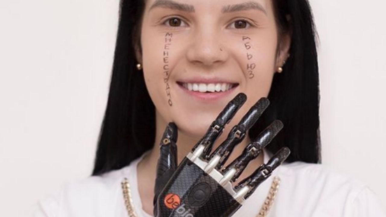 Rússia indenizará mulher que teve mão amputada