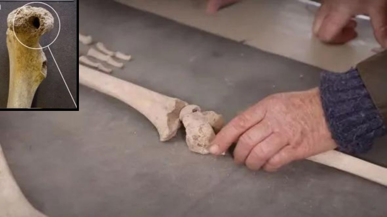 “Fantoche humano”: Esqueleto com furos intriga pesquisadores