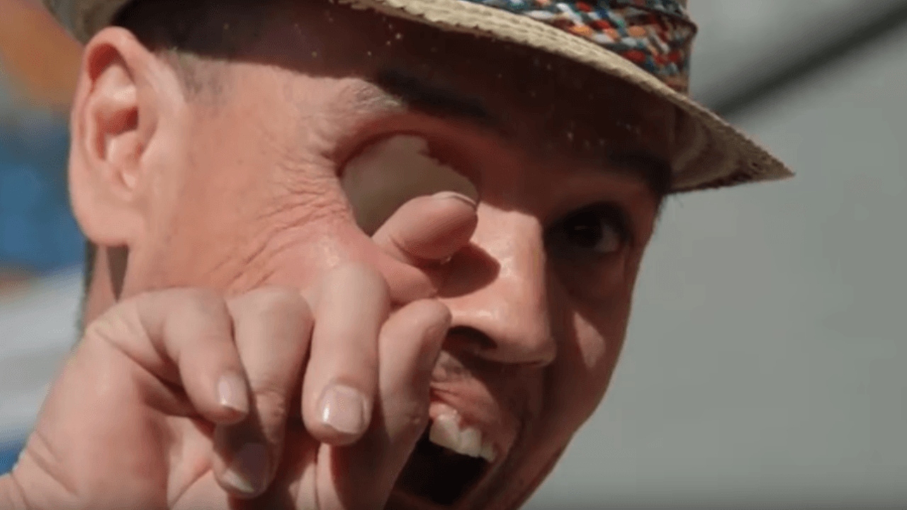 A reviravolta de Billy Owen: a impressionante história do americano que venceu um câncer nasal
