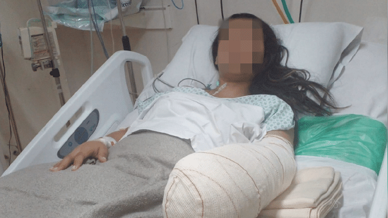 Após parto de terceiro filho, mulher tem braço e punho amputados em hospital